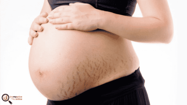 Pregnancy stretch mark kit and how to use it