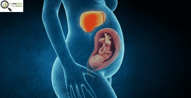 Cholestasis of pregnancy and its signs
