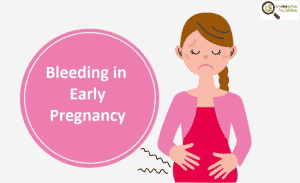 Bleeding during pregnancy causes and treatment