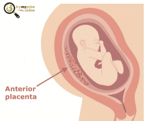 Anterior placenta bigger belly