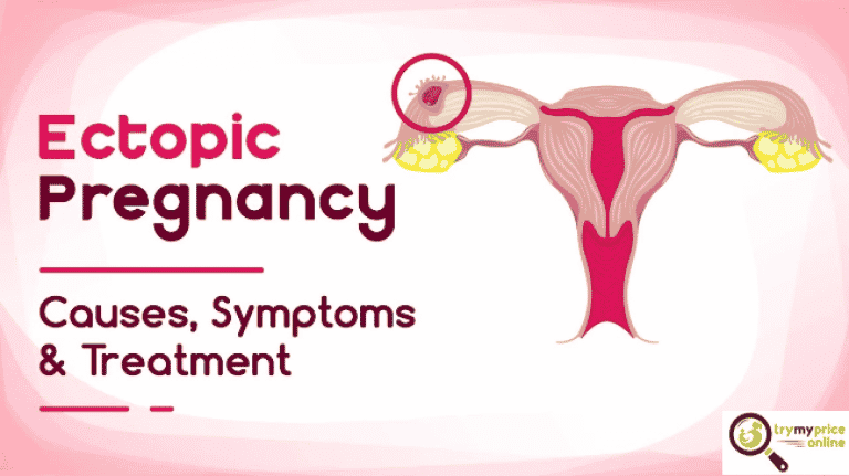 Ectopic pregnancy treatment options | Try my price online