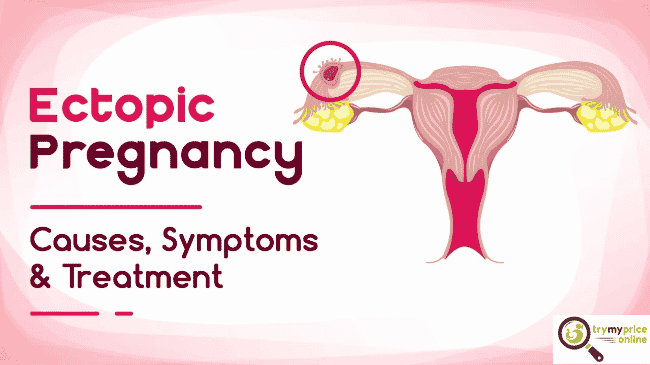 Ectopic pregnancy treatment options