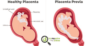Anterior placenta gender boy