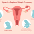 Pregnancy symptoms most early 4