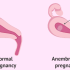 12 weeks pregnant baby development
